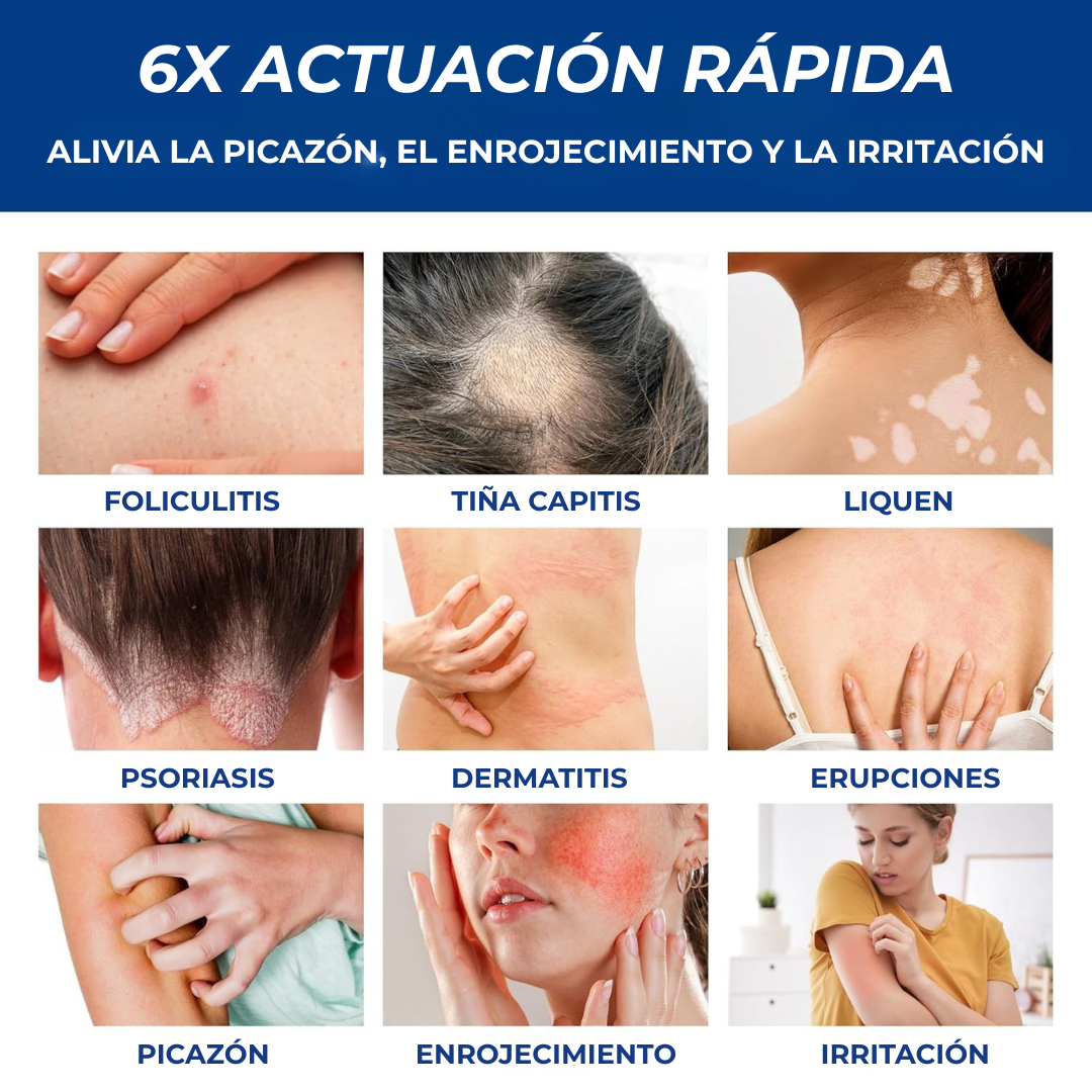 AVERA™ Crema Intensiva para Psoriasis
